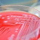 E. coli grown on a blood agar plate.